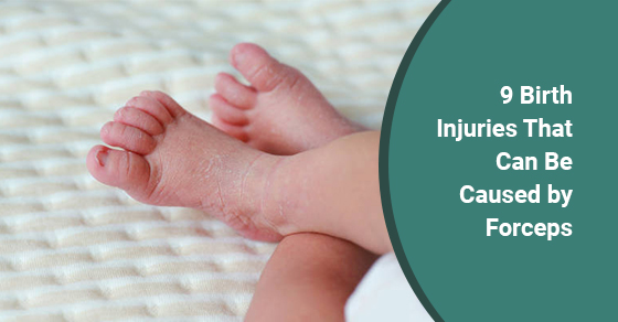 9 Birth Injuries That Can Be Caused by Forceps