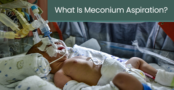 What is meconium aspiration?