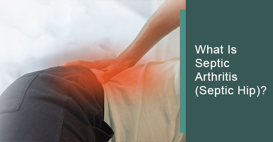 What is septic arthritis (Septic hip)?