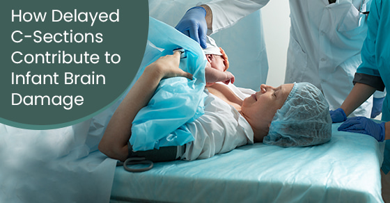 How Delayed C-Sections Contribute to Infant Brain Damage