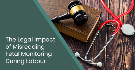 The Legal Impact of Misreading Fetal Monitoring During Labour